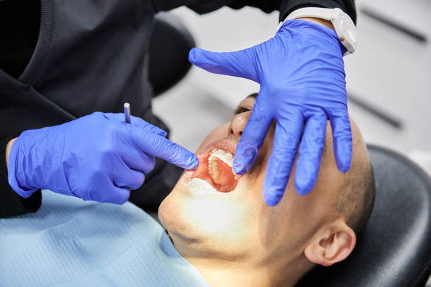 Best Emergency Treatment for Dental Infections or Abscesses in Whippany, NJ